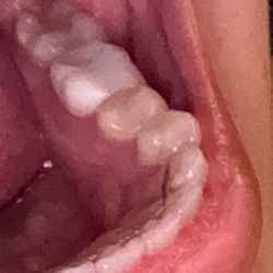 MillBridge Dentistry