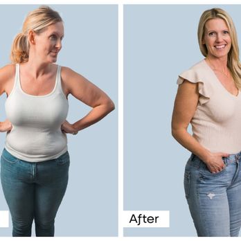 BelleSculpt - Body Contouring Near Me - Pleasant Grove, Utah