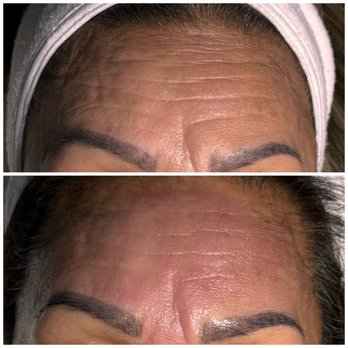 Skin Matters - Skin Care Near Me - Martinez, California Skin Matters - Skin Care Near Me - Martinez, California