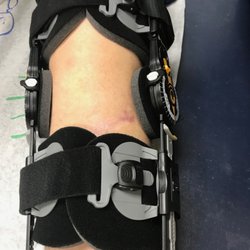 Dr. David W Roberts - New leg brace.