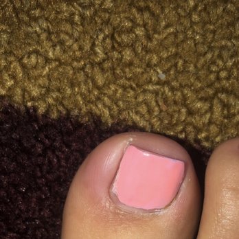StarNailsBar - Infection on my toe after a pedicure. - Nail Salons Near Me - Vista, California StarNailsBar - Infection on my toe after a pedicure. - Nail Salons Near Me - Vista, California