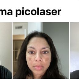 Before and after Before and after