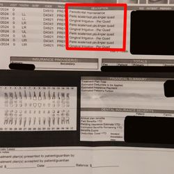 Cal Dental Anaheim - He said I didn't need a deep cleaning - others (and insurance) said otherwise.
