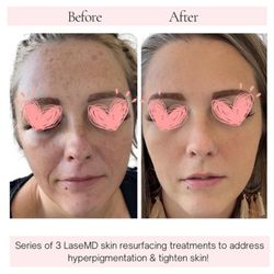 Meg & Co. Medical Aesthetics & Laser