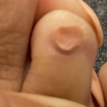 Mani Toes Gambrills - The caved in nail she created from aggressively filing because she had an attitude. - Nail Salons Near Me - Gambrills, Maryland Mani Toes Gambrills - The caved in nail she created from aggressively filing because she had an attitude. - Nail Salons Near Me - Gambrills, Maryland