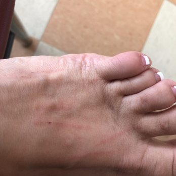 Palm Nails - Scratched foot - Day Spas Near Me - Palm Coast, Florida Palm Nails - Scratched foot - Day Spas Near Me - Palm Coast, Florida