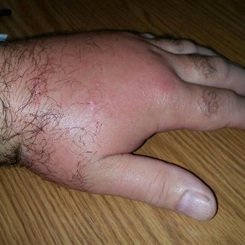 Busy Bee Pest Control - Be stings can be serious. Not for DIY - Pest Control Near Me - Chicago, Illinois
