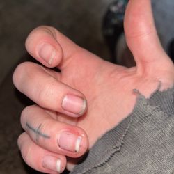 Le Nails - Infected fingers and rough surface