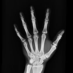 Absolute Chiropractic Care