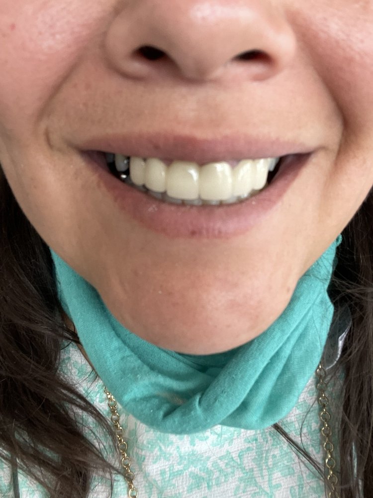 APEX DENTAL Updated September 2024 10 Photos & 10 Reviews 6330