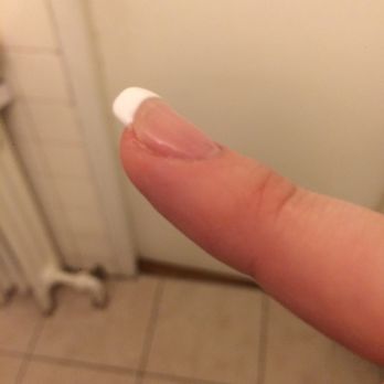 Rosy Nails - The nail that was very deformed and had a crack in the side - Nail Salons Near Me - Toronto, Ontario Rosy Nails - The nail that was very deformed and had a crack in the side - Nail Salons Near Me - Toronto, Ontario