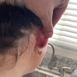 Scotty's Tattoo & piercings - Infected ear
