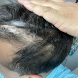 JMC Hair Restoration Center