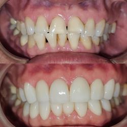 Amazing Dental - Before and after cosmetic dentistry