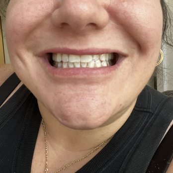 Magic Smile - After - Cosmetic Dentists Near Me - New York, New York Magic Smile - After - Cosmetic Dentists Near Me - New York, New York