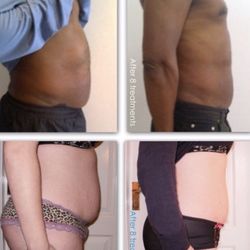 K&R Bodysolutions - No surgery no downtime and real results
