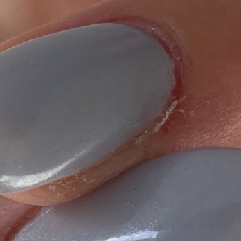 Bloomingnail's - Hard gel flooding the cuticle and sidewalls causing pain and discomfort. Overtime this can also cause contact dermatitis. - Nail Salons Near Me - Tiburon, California Bloomingnail's - Hard gel flooding the cuticle and sidewalls causing pain and discomfort. Overtime this can also cause contact dermatitis. - Nail Salons Near Me - Tiburon, California