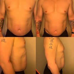 Live Well 360 Beauty & Wellness Center - Male love handle slimming and toning