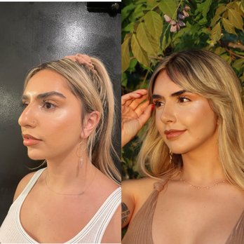 Jason Roostaeian, MD - Rhinoplasty, Septoplasty, chin implant - Cosmetic Surgeons Near Me - Los Angeles, California Jason Roostaeian, MD - Rhinoplasty, Septoplasty, chin implant - Cosmetic Surgeons Near Me - Los Angeles, California