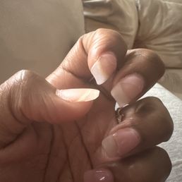 Full set with gel polish peeled off. Full set with gel polish peeled off.