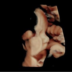 Advanced Ultrasound Services
