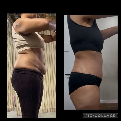 best lipotropic and b12 injections wellington fl PRECISION MEDICAL SPECIALISTS - Updated June 2026 - 81 Photos - 3319 State  Road 7, Wellington, Florida - Plastic Surgeons - Phone Number