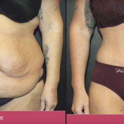 Center For Cosmetic & Reconstructive Surgery