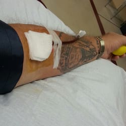 LifeSouth Community Blood Center - No pain