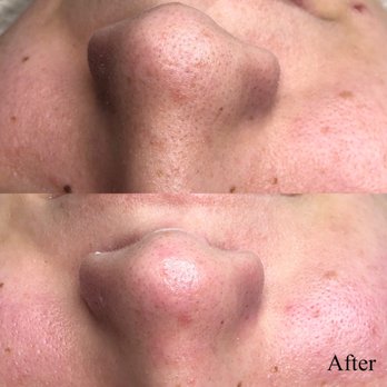 Impressive Beauty By Nhung - Permanent Makeup Near Me Impressive Beauty By Nhung - Permanent Makeup Near Me