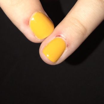 Lovely Nails - Injuries from Dremel tool used by nail tech. - Nail Salons Near Me - Rolla, Missouri Lovely Nails - Injuries from Dremel tool used by nail tech. - Nail Salons Near Me - Rolla, Missouri