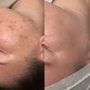 Photo of Puresthetics Skin Care