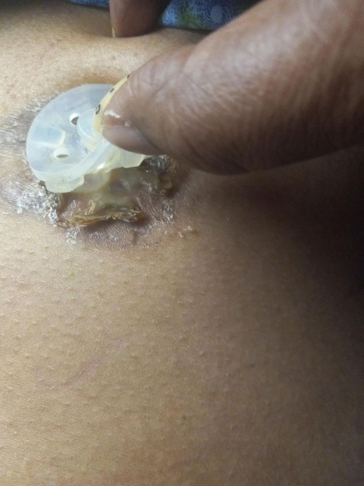 Park Rose Care Center - patient advocate in Tacoma, WA