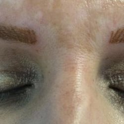 Right after Permanent Eyebrow procedure
