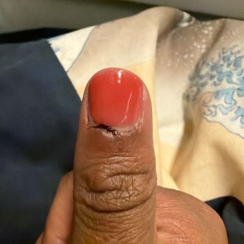 Ginger Nail and Spa - The worst finger - Nail Salons Near Me - Rockville, Maryland Ginger Nail and Spa - The worst finger - Nail Salons Near Me - Rockville, Maryland