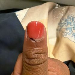 Ginger Nail and Spa - The worst finger