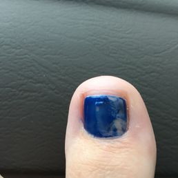 The terrible pedicure I received. The terrible pedicure I received.