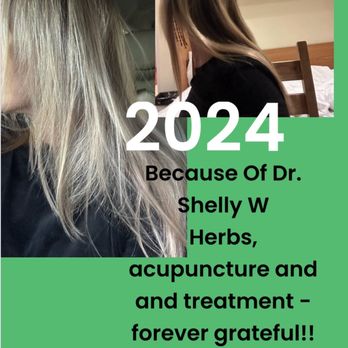 Rapha Acupuncture and Herbs - She saved me!!Not having hair really affected me - I am so grateful for her thoughtful care and wisdom in treatments. - Acupuncture Near Me - Arcadia, California Rapha Acupuncture and Herbs - She saved me!!Not having hair really affected me - I am so grateful for her thoughtful care and wisdom in treatments. - Acupuncture Near Me - Arcadia, California