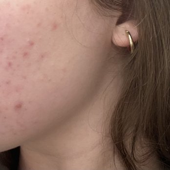 Deram Cosmetic Surgery - Dermatologists Near Me - Fountain Valley, California Deram Cosmetic Surgery - Dermatologists Near Me - Fountain Valley, California