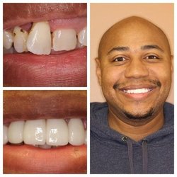 Simply Dental