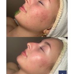 Face Integrity