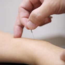 Wendy’s Acupuncture & Rehab Clinic