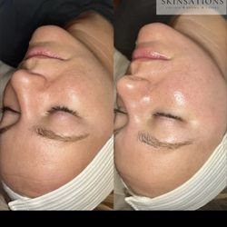 Skinsations By Beth - Lass lift