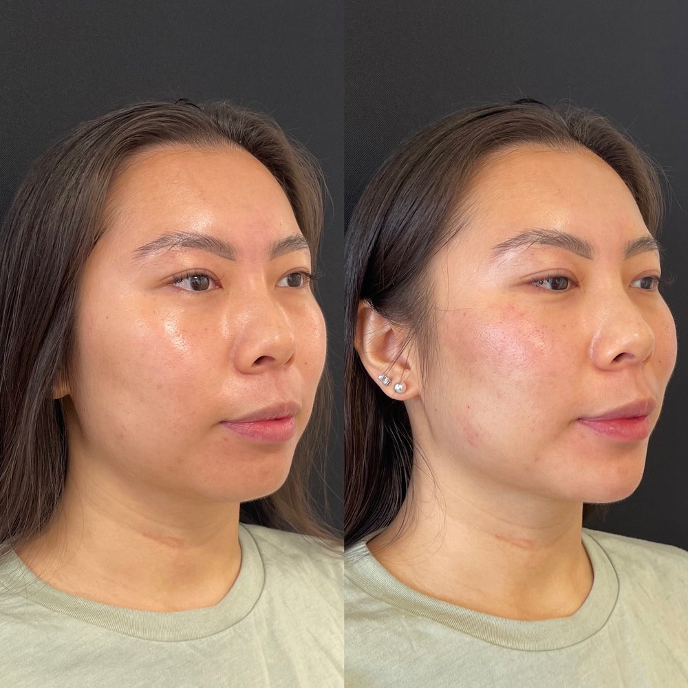 Jenn Rosenfeld Aesthetics Logo