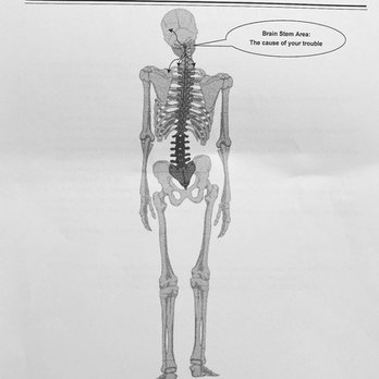 Upper Cervical Health Centers Boise - Upper Cervical Misalignment - Chiropractors Near Me - Boise, Idaho Upper Cervical Health Centers Boise - Upper Cervical Misalignment - Chiropractors Near Me - Boise, Idaho