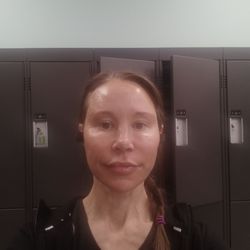 Beautiful Canadian Laser & Skin Care Clinic - Before
