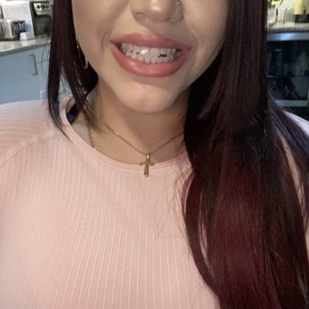 VPrii Whitening - Teeth Whitening Near Me - Plainfield, Illinois VPrii Whitening - Teeth Whitening Near Me - Plainfield, Illinois