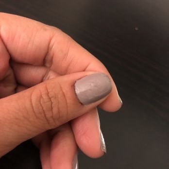 Rubys Nail Spa - Nails took forever to dry (hence the uneven nail polish surface) and while cleaning my cuticles around my thumb I started to bleed. - Nail Salons Near Me - Concord, California Rubys Nail Spa - Nails took forever to dry (hence the uneven nail polish surface) and while cleaning my cuticles around my thumb I started to bleed. - Nail Salons Near Me - Concord, California