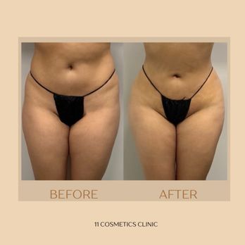 11 Cosmetics Clinic - Medical Spas Near Me - Burbank, California 11 Cosmetics Clinic - Medical Spas Near Me - Burbank, California