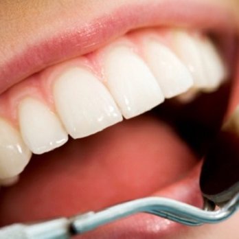 Clinique Dentaire Malka - Dentiste Villeray - General Dentistry Near Me - Montreal, Quebec Clinique Dentaire Malka - Dentiste Villeray - General Dentistry Near Me - Montreal, Quebec