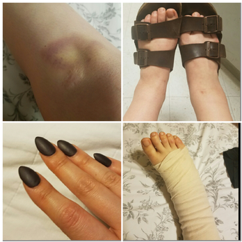 Megacare Nails & Spa - Ugly nails. Sprained ankle. Cost me $35+$75. This place is not what they say. - Waxing Near Me - Arcadia, California Megacare Nails & Spa - Ugly nails. Sprained ankle. Cost me $35+$75. This place is not what they say. - Waxing Near Me - Arcadia, California